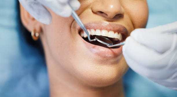 Best Emergency Root Canal Treatment in Weatherby Lake, MO