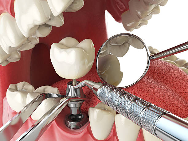 Best Emergency Denture Repair in Weatherby Lake, MO